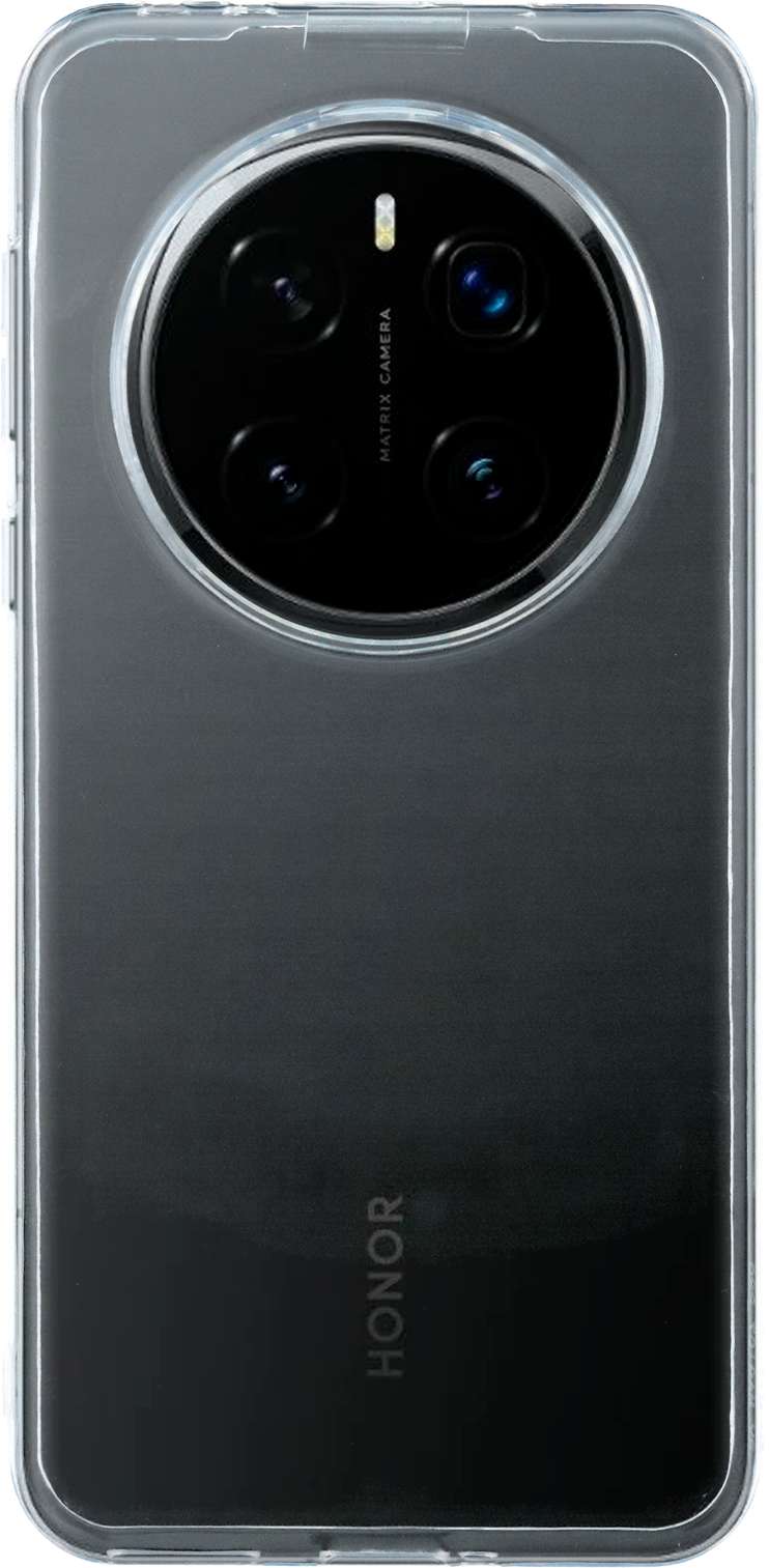 Étui personnalisé pour Honor Magic7 Pro
