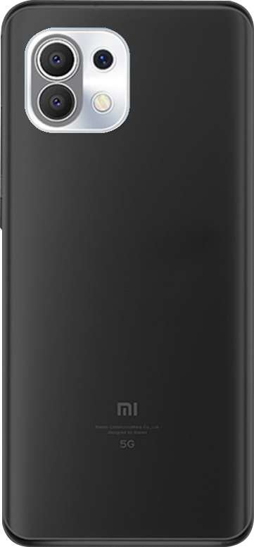 Coque personnalisée pour Xiaomi Mi 11