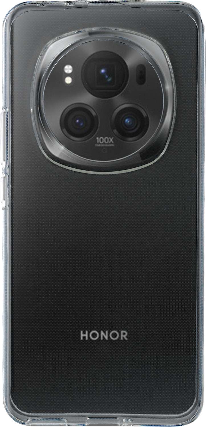 Coque personnalisée pour Honor Magic6 Pro